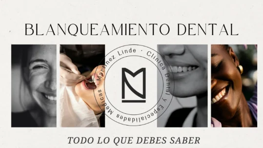 blanqueamientodentalalmería