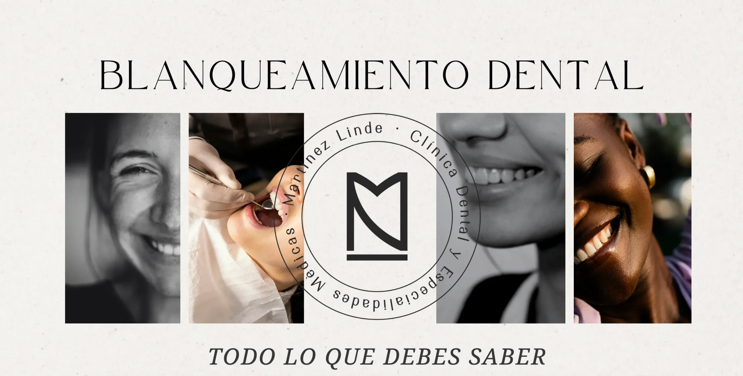 blanqueamientodentalalmería