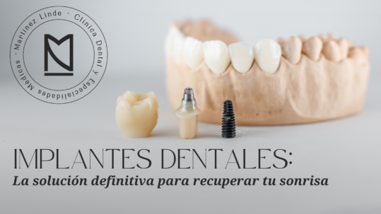 implantes dentales en almeria