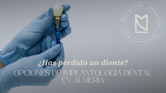 implante dental almeria
